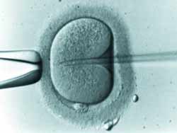 Inseminación in vitro